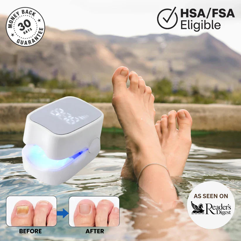Mavriy™ - Nail Fungus Laser Device